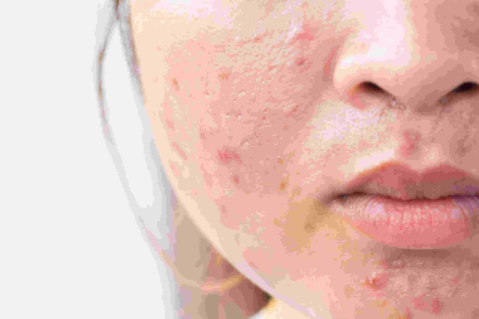 munhase ko kaise theek karen